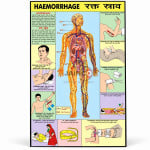 Hemorrhage Chart